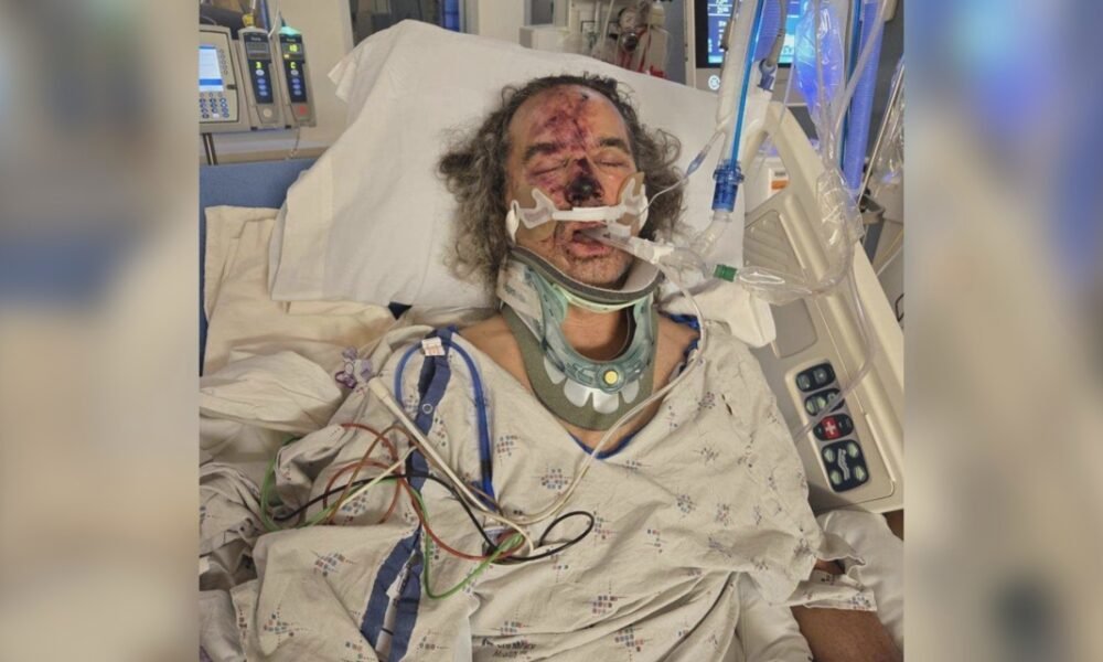 Miracle on Mt. Hood: Scottsdale man survives 700-foot fall