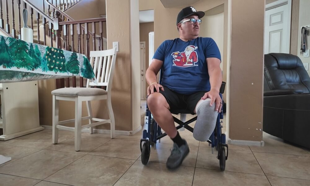 West Valley nurse loses his leg after contracting rare bacterial infection while on vacation