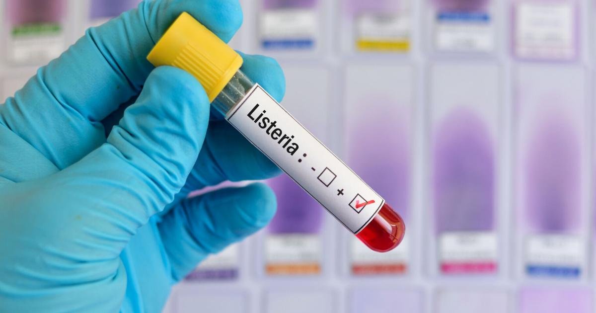 At least 10 people sickened in western US listeria outbreak linked to prepared foods