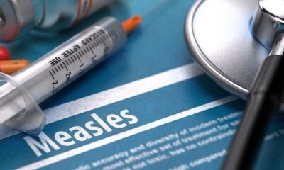 Mohave County monitors measles risk after Utah traveler exposes region