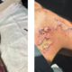 Phoenix woman sues police for causing horrible pavement burns