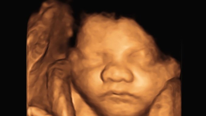 4D ultrasound